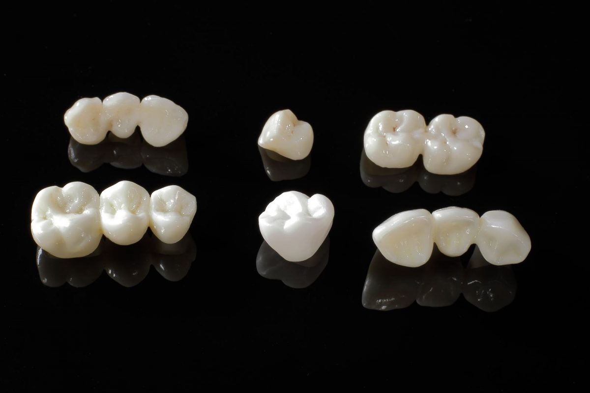 Niềng răng trong suốt Invisalign