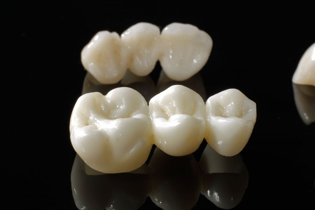 Trồng răng Implant