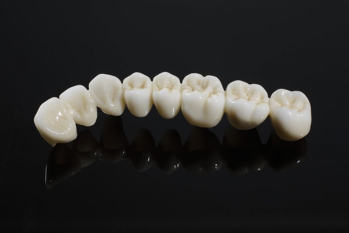 Niềng răng trong suốt cho Teen